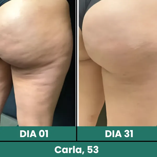 depoimento 08